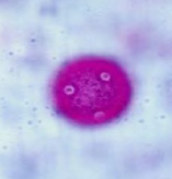 <p>type of pollen? </p>
