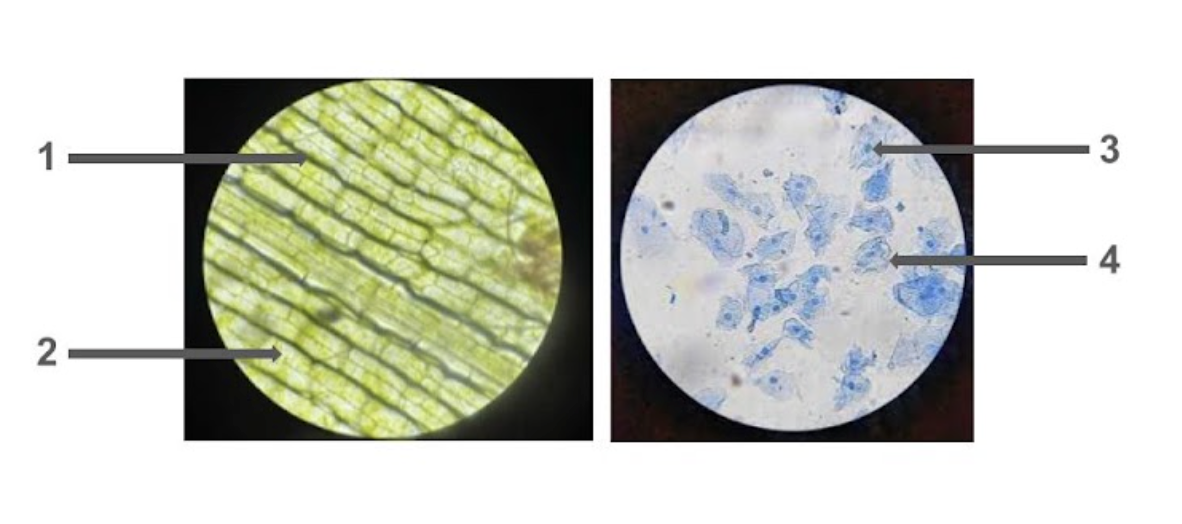 <p><span style="line-height: 1.5;">22. Observe the micrographs below. Which of the following correctly identifies the structure responsible for maintaining cell shape and protection in plant cells and the location of DNA in animal cells?<br>A. 1 = Cell wall, 3 = Nucleus</span></p><p><span style="line-height: 1.5;">B. 2 = Chloroplast, 3 = Cell wall</span></p><p><span style="line-height: 1.5;">C. 1 = Chloroplast, 3 = Cell membrane</span></p><p><span style="line-height: 1.5;">D. 1 = Cell wall, 4 = Nucleus</span></p>