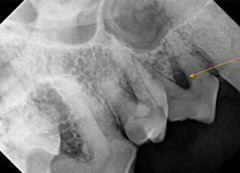 <p>What is this pointing to?</p>