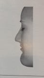 <p>forehead, upper lip, and chin project to an imaginary vertical line</p>