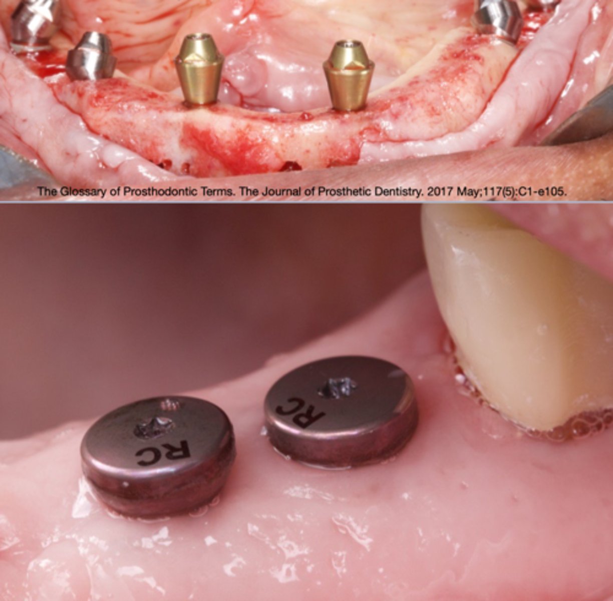 <p>What is this? (Top Picture)</p>