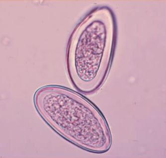 <p>egg of what nematode?</p>