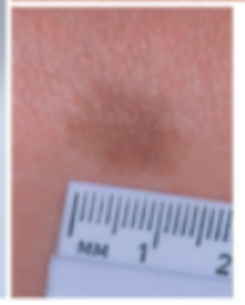 term image