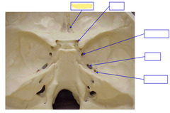 <p>Cranial Foramina</p>