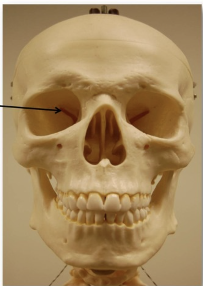 <p>which projection is this? (narrow slit along a bone)</p>