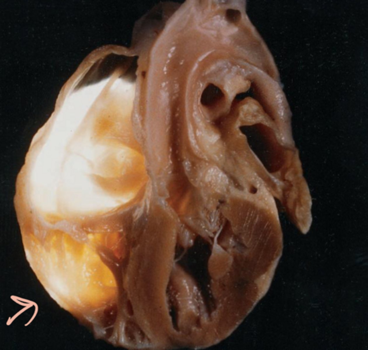 <p>Identify the condition?</p>