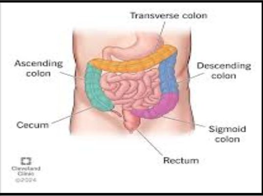 <ul><li><p>Cecum</p></li><li><p>Ascending Colon</p></li><li><p>Transverse Colon </p></li><li><p>Descending Colon </p></li><li><p>Sigmoid Colon </p></li><li><p>Rectum </p></li></ul><p></p>