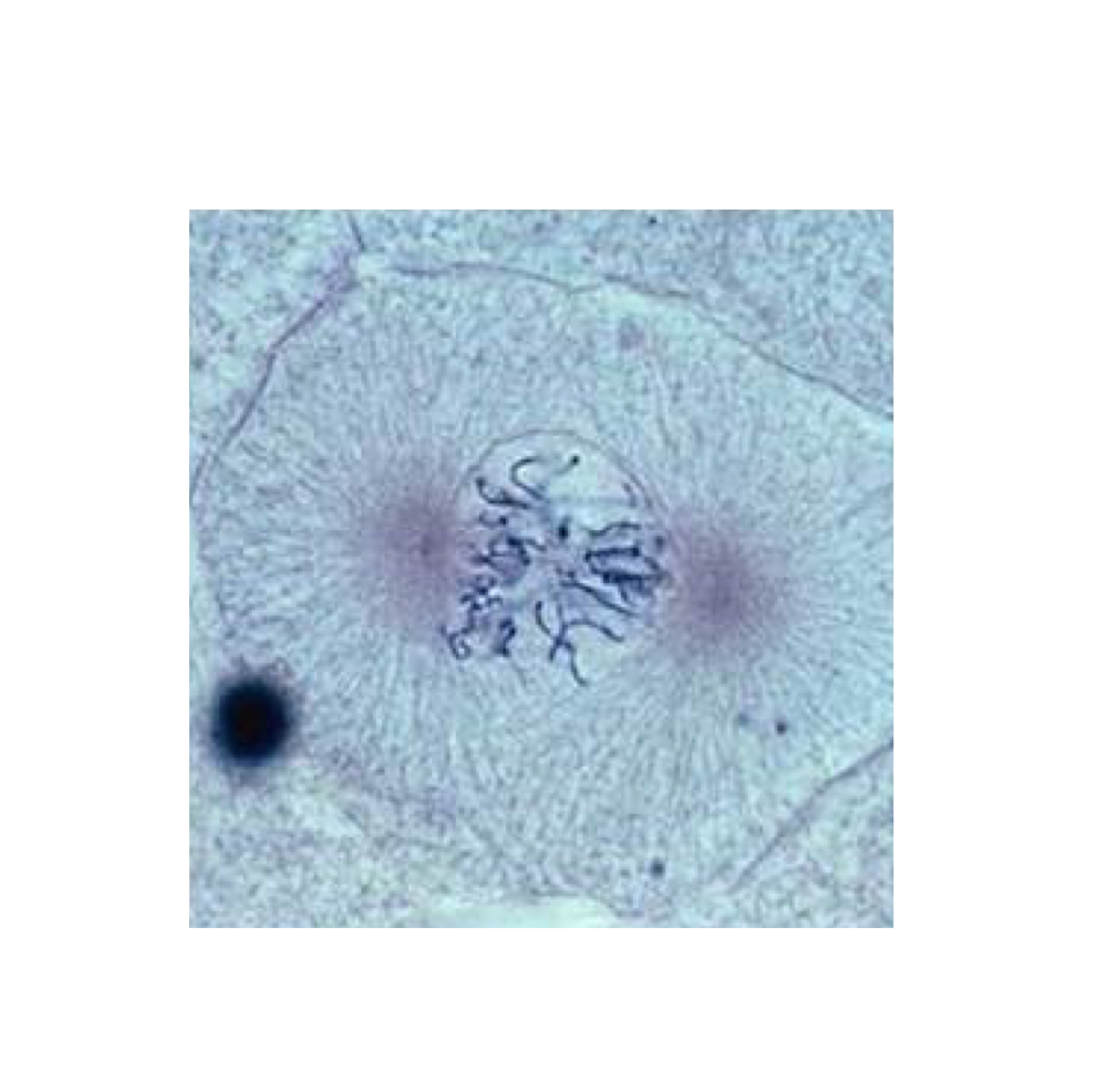 <p>What phase of mitosis is this?</p>