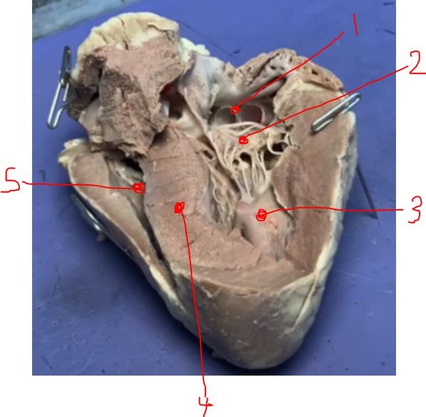 <p><span>Identify the following:&nbsp; left ventricle</span></p>