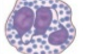 <p>Basophil </p>