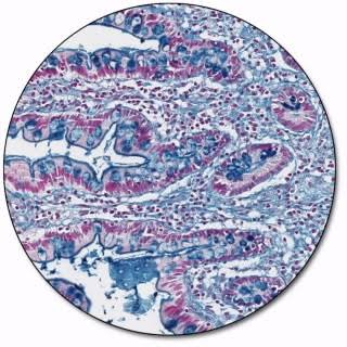 <p>Colloidal Iron</p>