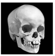 <p>age 6 skull</p>