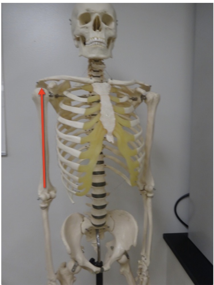 <p>Name the directional term (closer to where limb attatches to the body trunk)</p>