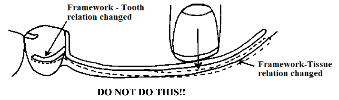 <p>How should you hold/adapt the tray in the mouth?</p>