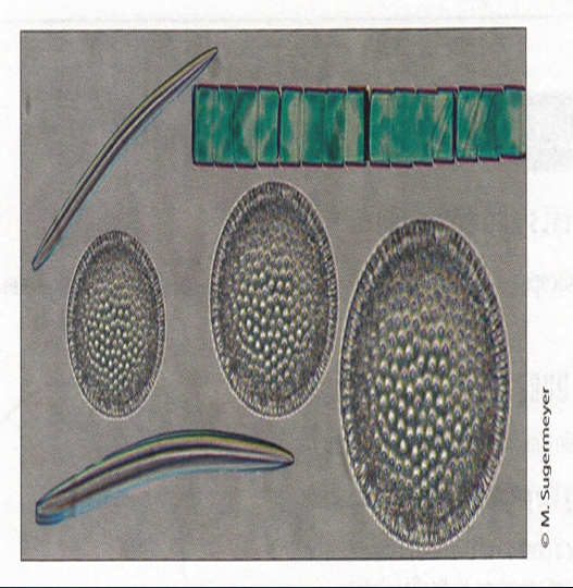 <ol><li><p>What is the algal protists seen here?</p></li><li><p>What is their cell wall made of?</p></li><li><p>These protists are an example of what?</p></li><li><p>These protists store what substance that aids in buoyancy?</p></li></ol><p></p>