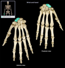 <p>remember the scaphoid in the carpal bones!!!</p>