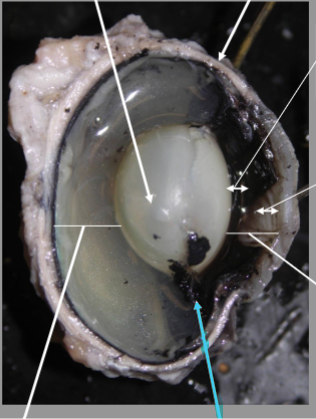 <p>What is the arrow pointing at?</p>