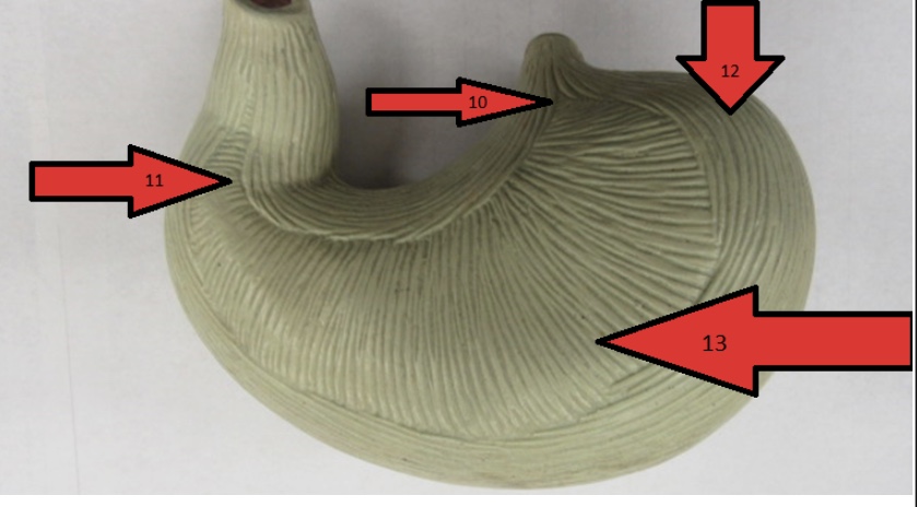<p>What organ is this?</p>