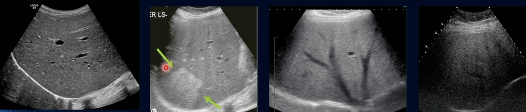 <p>Pathology? Which is Normal and whats the worst</p>