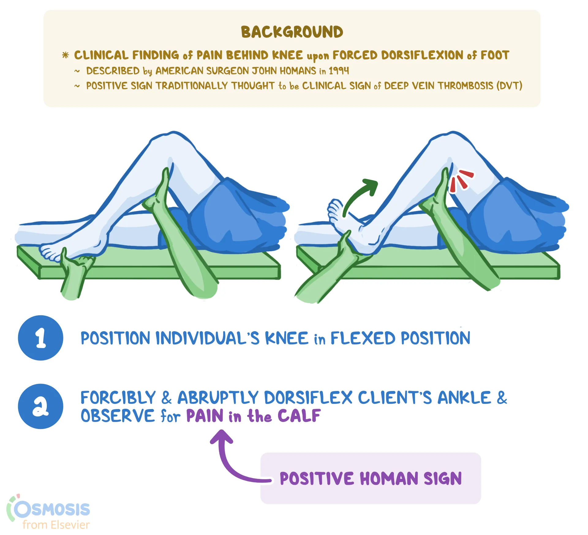 <p>A test for DVT; Considered positive for DVT when flexing the ankle and pain is felt in the calf</p>