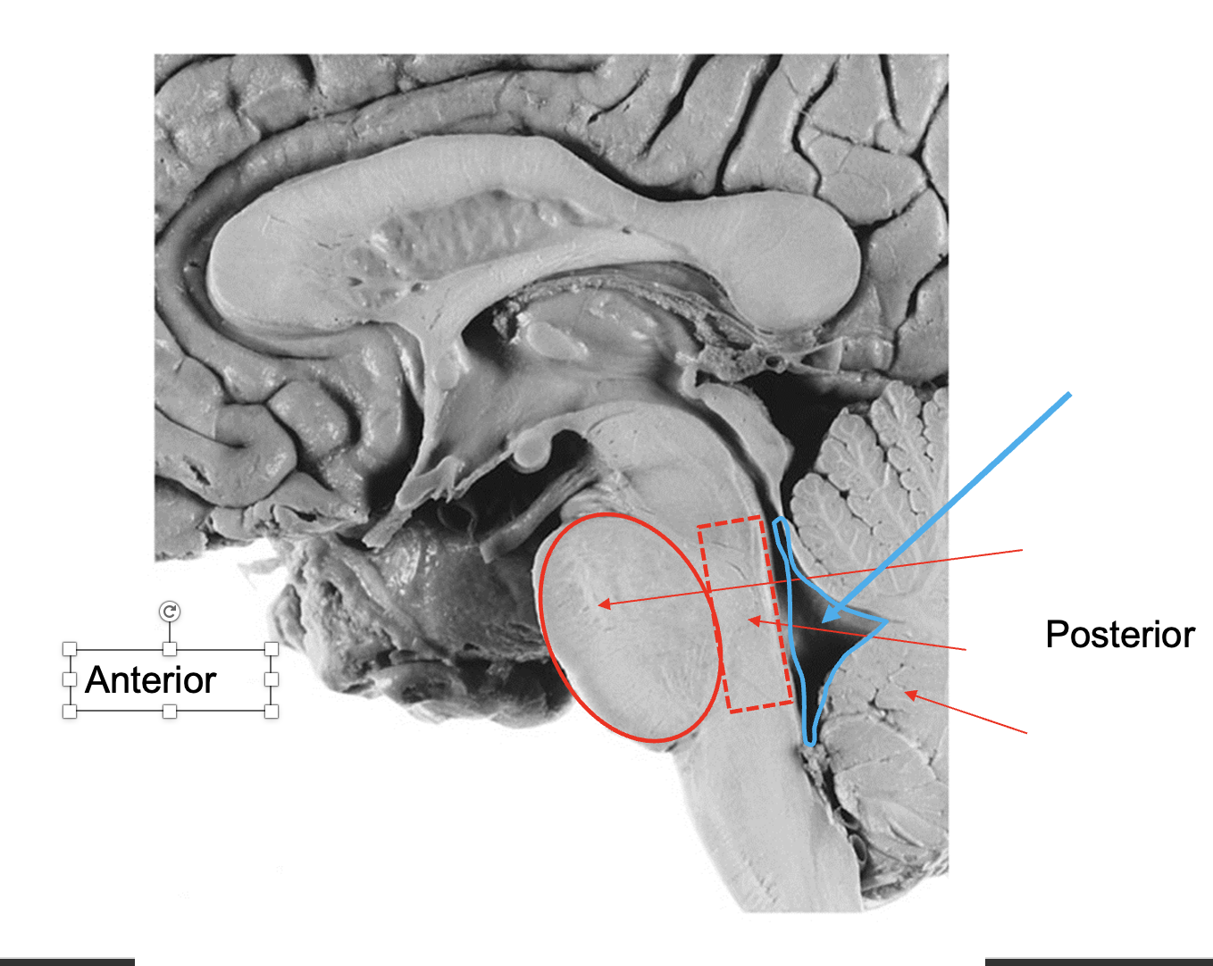 <p>Name these structures from anterior to posterior</p>