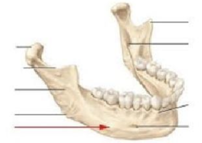 <p>What part of the mandible is shown by the red arrow in the picture?</p><p>A. Condyle </p><p>B. Coronoid process </p><p>C. Body </p><p>D. Mental nerve </p><p>E. Symphysis</p>