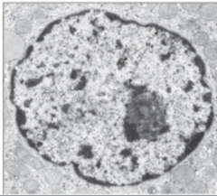 <p>Identify the following structures in electron micrograph (the whole structure)</p>