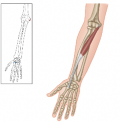 <p>What is the muscle highlighted?</p>