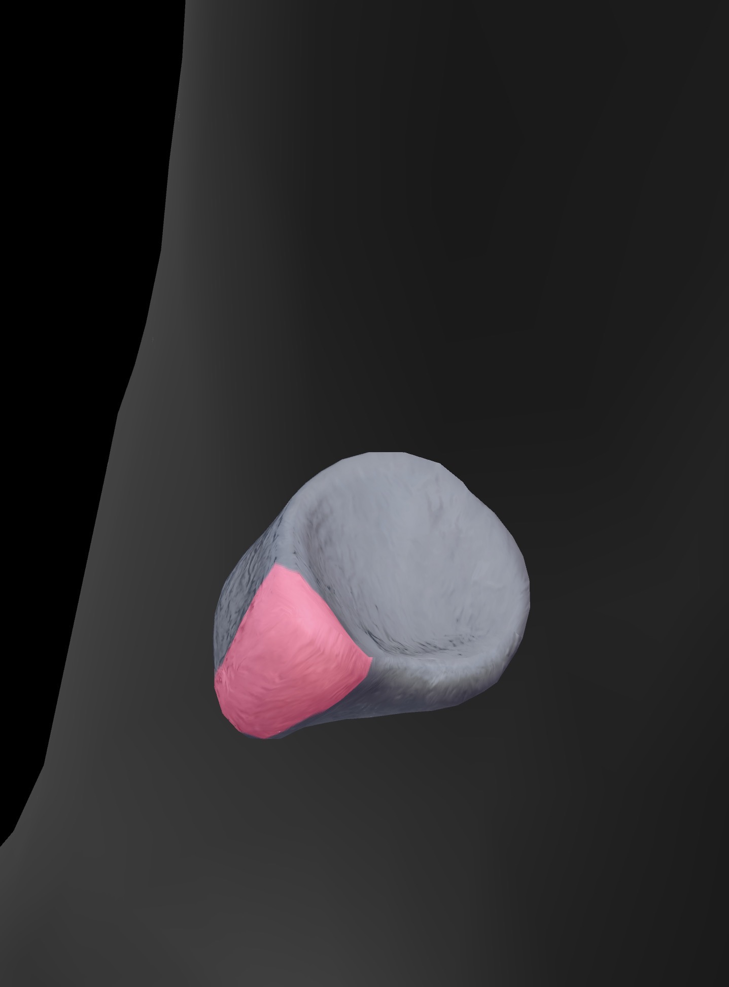 <p>What bone is this? What are the bone landmarks?</p>