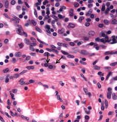 <p>What type of cells are indicated?</p>