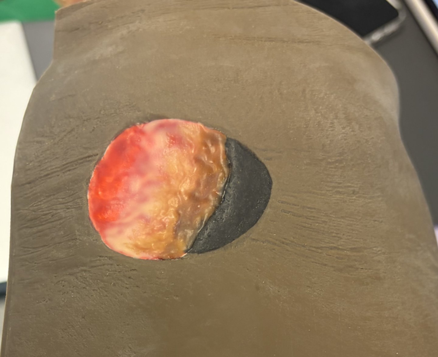 <p>what wound is this?</p>