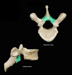<p>What is the indicated part and vertebrae?</p>