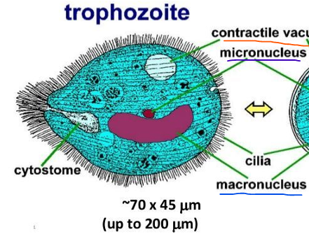 <p>pointed; cytosome; food; cilia</p>
