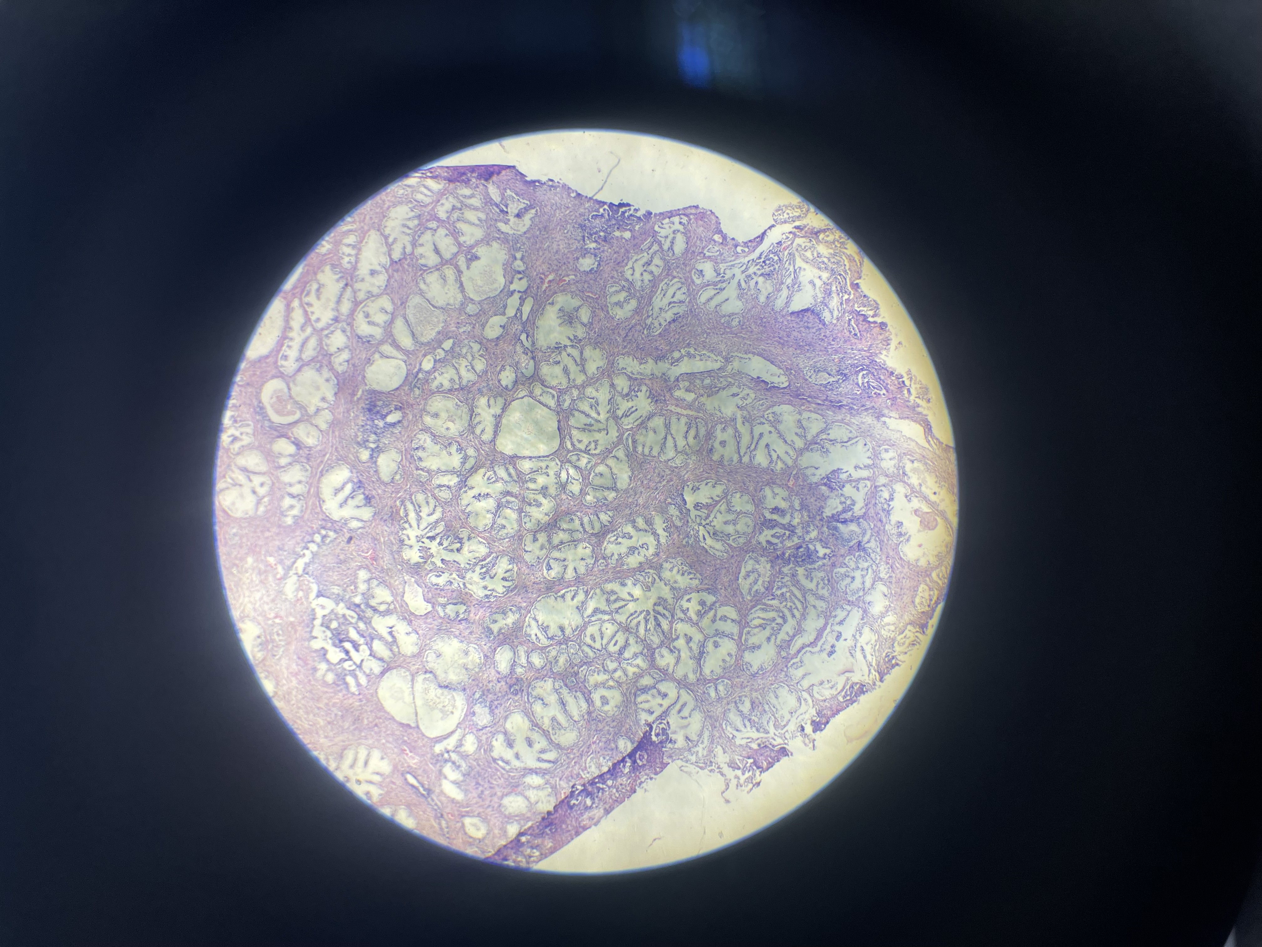 <p>What is the diagnosis?</p>