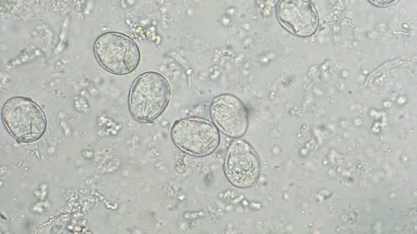 <img src="blob:null/ed988cba-379f-41a4-89cf-10646daa3ce9"><p></p>