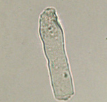 <p>Seen with chronic renal failure</p><p>Slightly opaque, blunt edges</p>