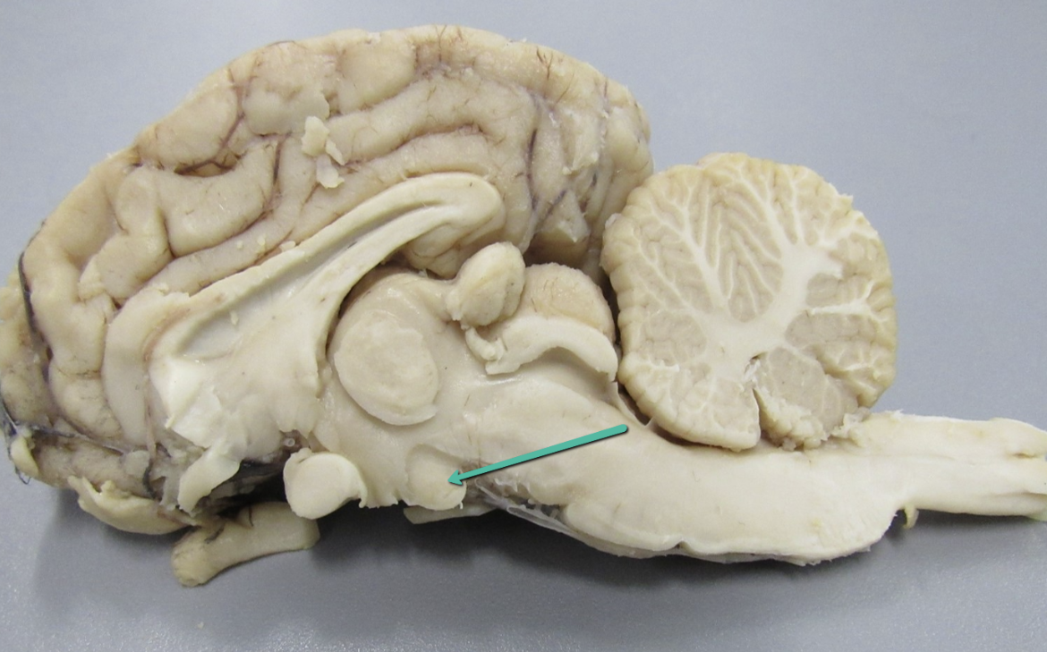 <p><strong>Sheep Brain Practice Quiz</strong></p><p>Identify the structure indicated by the pointer.</p>