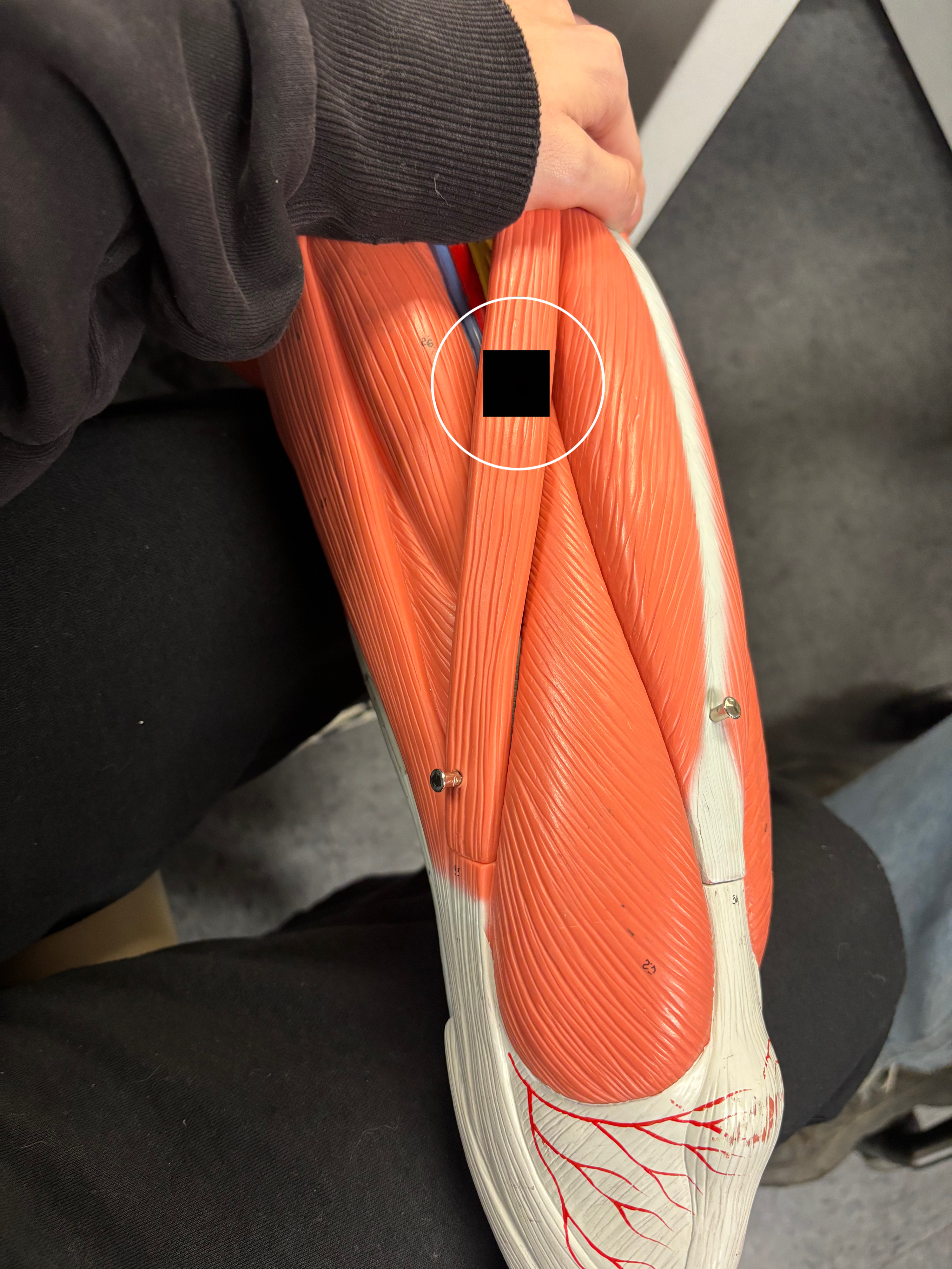 <p>What muscle is this and what is its action?</p>