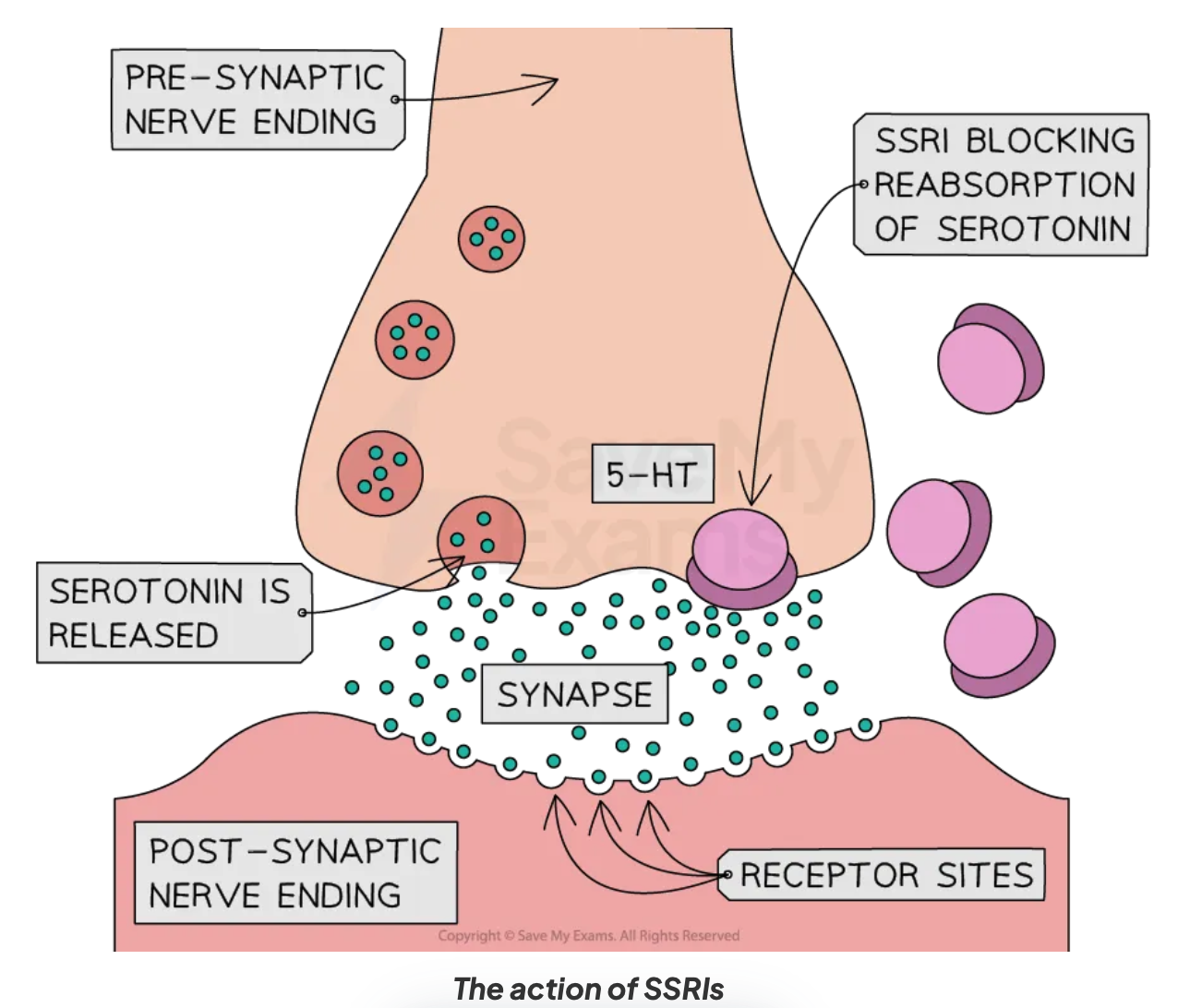 <ul><li><p>Antidepressant drugs used to tackle low levels of serotonin are known as <strong>Selective Serotonin Reuptake Inhibitors (SSRIs)</strong></p><ul><li><p><strong>Reuptake </strong>occurs when <strong>molecules</strong> of serotonin do not cross the<strong> synaptic cleft</strong> i.e. they have not been transmitted to the <strong>postsynaptic neuron</strong></p><ul><li><p>The ‘spare’ molecules of serotonin are then taken back up into the <strong>presynaptic</strong> neuron</p></li></ul></li><li><p>SSRIs work by <strong>preventing</strong> (or<strong> inhibiting</strong>)<strong> </strong>the reuptake of serotonin in the <strong>synaptic cleft</strong> back into the<strong> presynaptic neuron</strong></p></li><li><p><strong>Prevention of reuptake</strong> makes serotonin more<strong> accessible</strong> in the brain</p></li><li><p>More serotonin is then available to improve the transmission of <strong>messages</strong> between <strong>neurons</strong></p></li><li><p>SSRIs are called <strong>selective </strong>because they mainly affect serotonin, not other neurotransmitters such as <strong>dopamine</strong></p></li><li><p>SSRIs are commonly used to treat <strong>depression </strong>but they have also been found to be effective in the treatment of OCD</p></li></ul></li></ul><p></p>