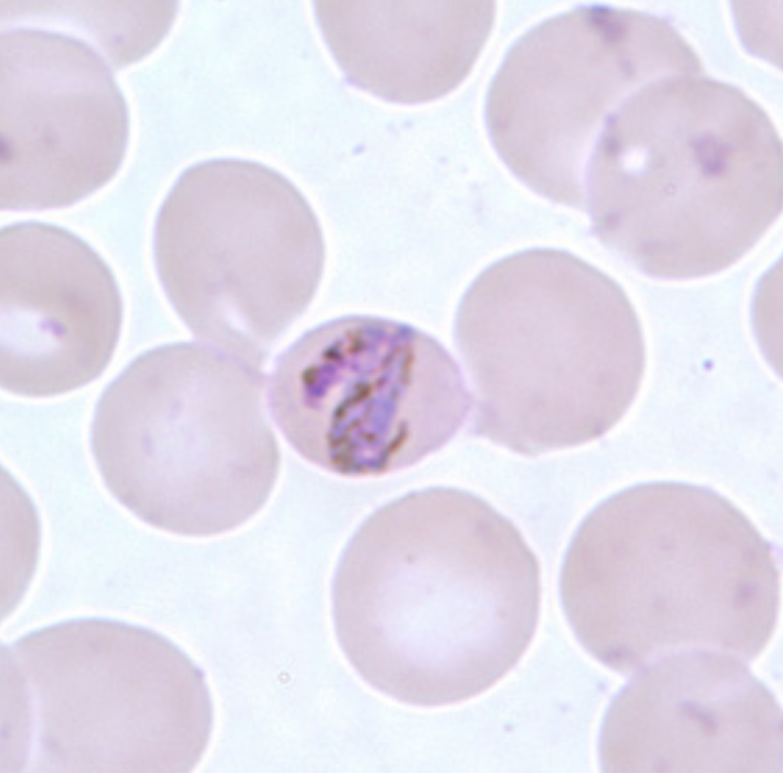 <p>What parasite is this?</p>