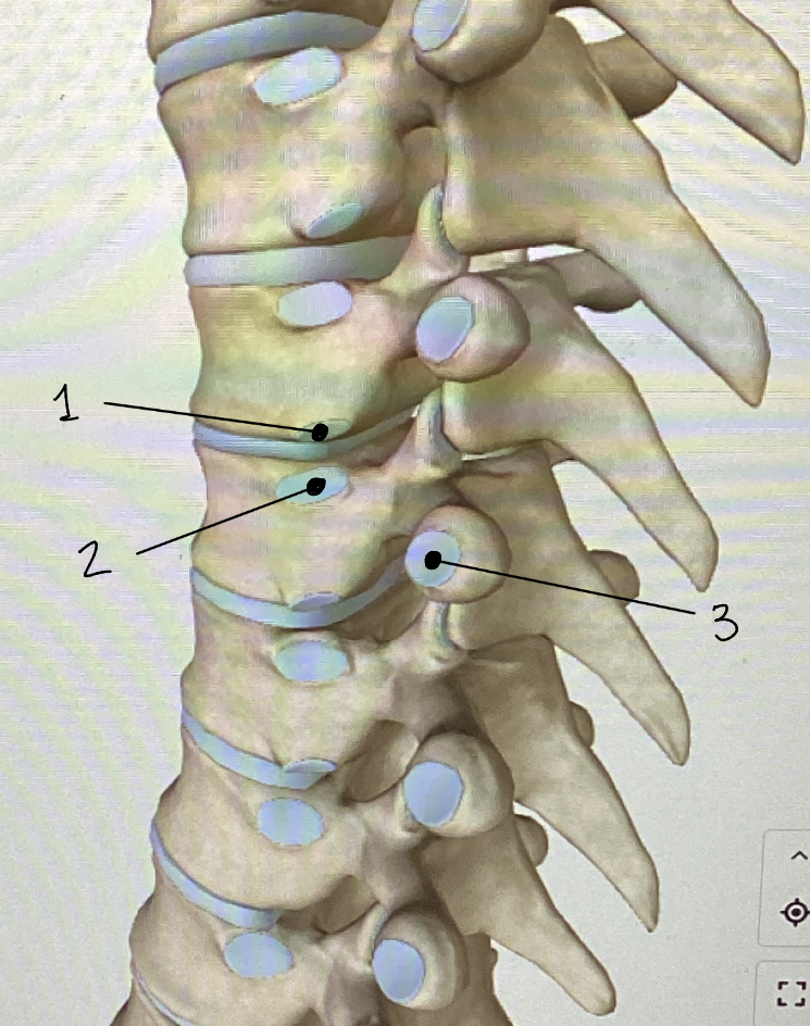 <p>What type of vertebrae are these? Identify each point</p>