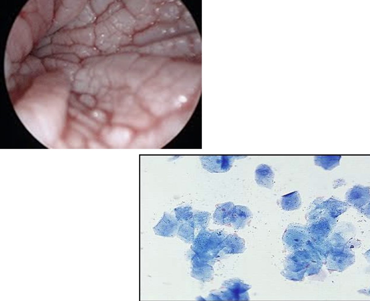 <p>After sequentially monitoring a female dog that was initially in proestrus every other day for two weeks, the vaginoscopy + vaginal cytology results are as shown in the pictures. What stage of the estrous cycle is she most likely in?</p>