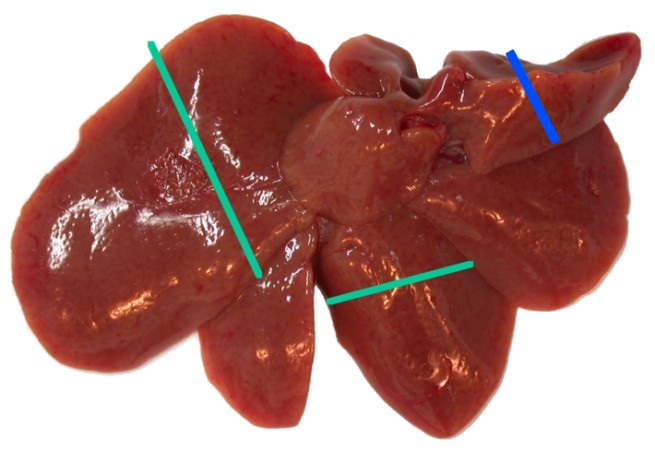 <p>Liver</p>