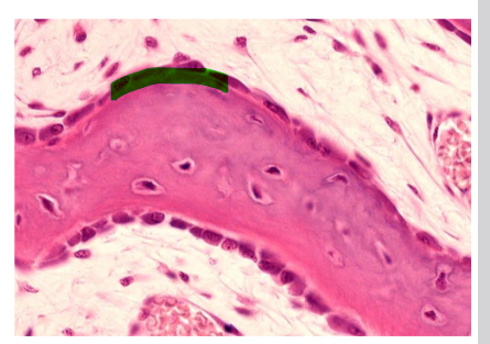<ul><li><p>aktyvūs gamina osteoidą: I tipo kolageną, PG, GP. Išskiria šarminę fosfataz</p></li><li><p>išsidėstę tinklinio skaidulinio kaulo plokštelės pav.</p></li><li><p>kubo f. - aktvios, plokščios - neaktyvios</p></li><li><p>turi poliariškumą</p></li></ul><p></p>