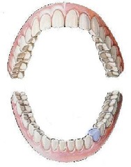 <p>mandibular left first bicuspid</p>