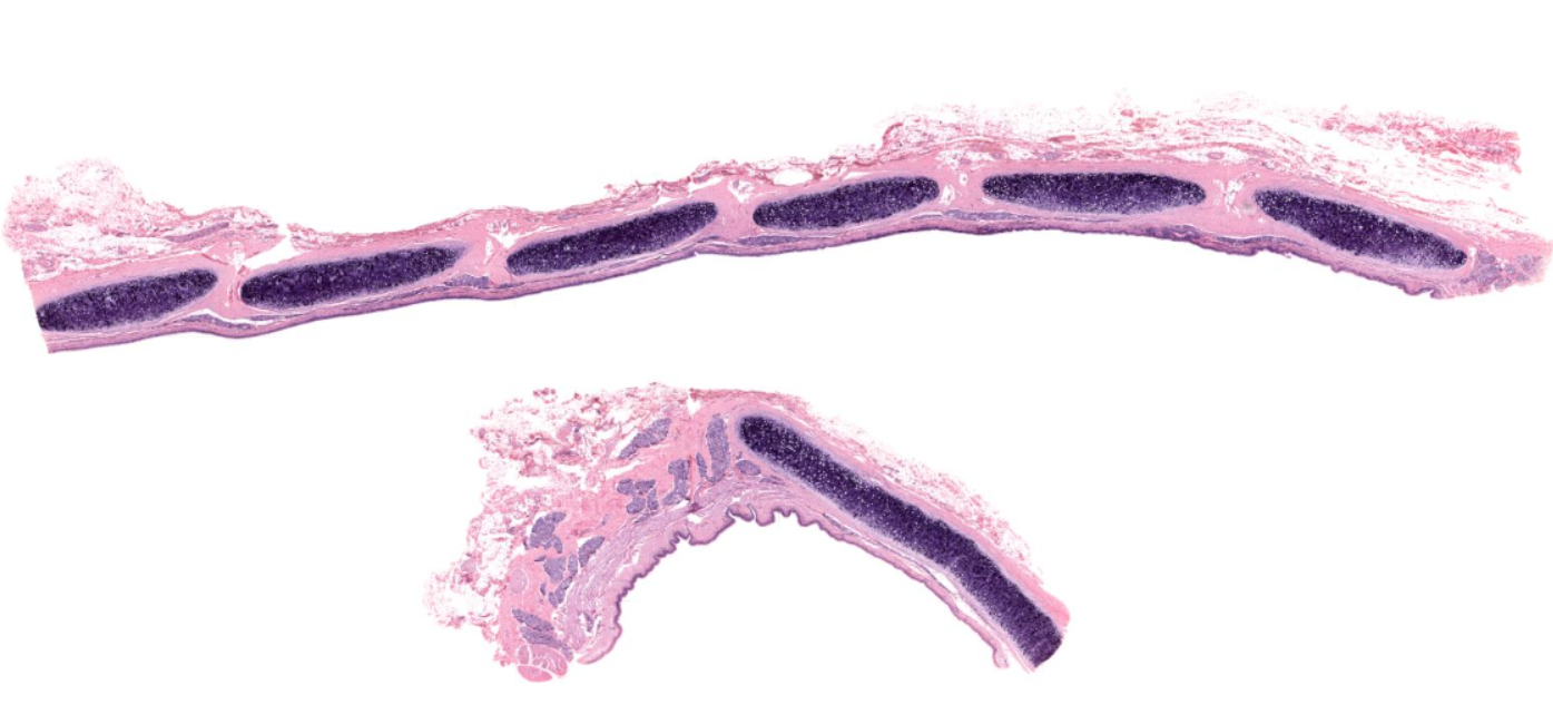 <p>What type of cartilage exists as C-shaped rings in the trachea?</p>