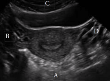 <p><span style="background-color: transparent;">What is letter B in this image?&nbsp;</span></p><p><span style="background-color: transparent;">a. Superior&nbsp;</span></p><p><span style="background-color: transparent;">b. Right&nbsp;</span></p><p><span style="background-color: transparent;">c. Anterior&nbsp;</span></p><p><span style="background-color: transparent;">d. Posterior&nbsp;</span></p>