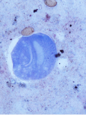 <ul><li><p>causes balantidiasis </p></li></ul><p></p>
