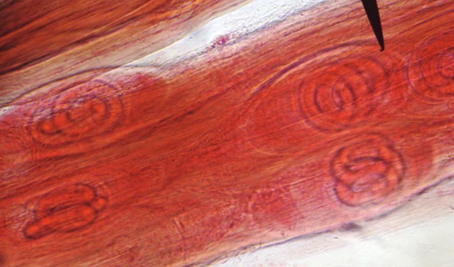 <p>What nematode/roundworm/parasitic worm is this?</p>