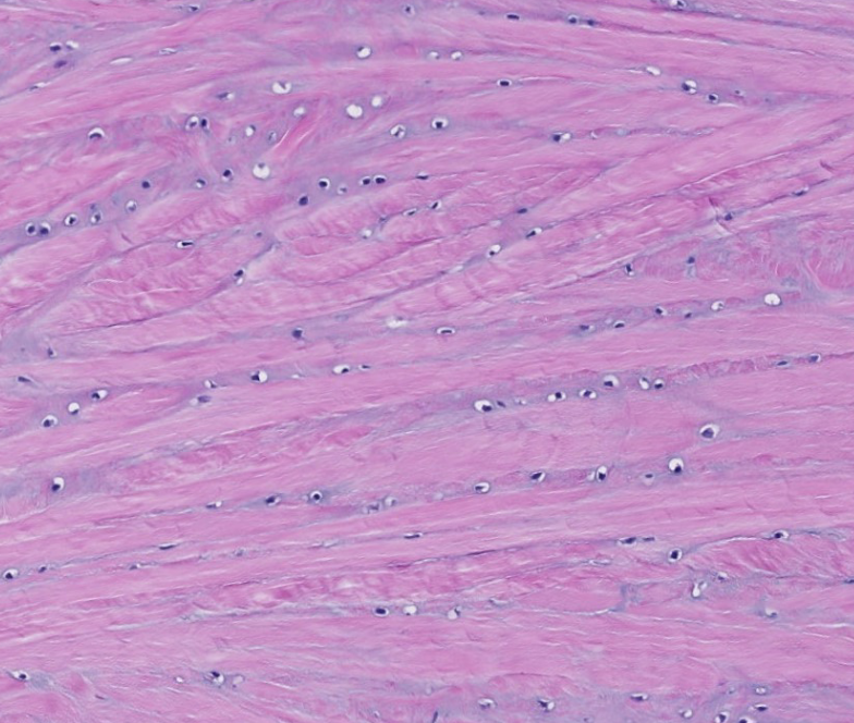 <p>which type of CT is this?</p>